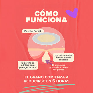 FACEIT Parches - 18pz