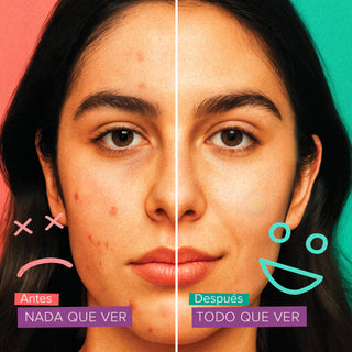 FACEIT Parches - 18pz