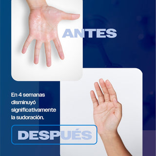 Skindry Sensitive - Antitranspirante - 20ml