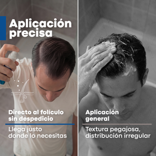 Anacastel Minoxidil 5% | 3 Meses de Tratamiento Anticaída para Cabello y Barba | Presentación Spray 60ml