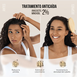 Anacastel Minoxidil 2% - Auxiliar en el Tratamiento Anticaída - 60ml