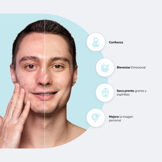 Bpollen Peróxido de Benzoilo Gel 2.5% - 60g