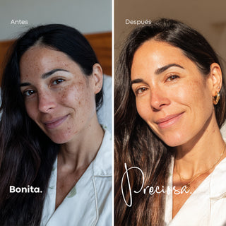 Pack Despigmentante - Day & Night