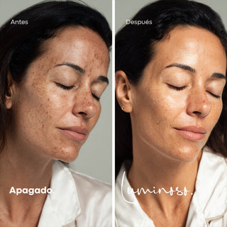 Pack Despigmentante - Day & Night